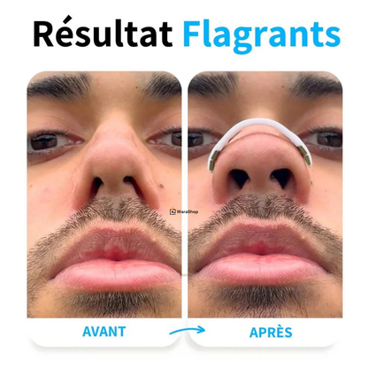 Bandelettes Nasales Anti-Ronflement – Respirez Mieux, Dormez Mieux !